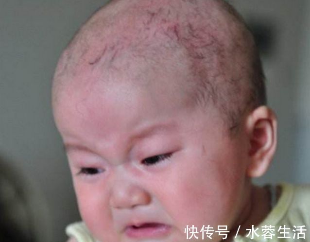 老人|奶奶任由2岁孩子吃油腻食物,竟然胖到40斤,宝妈:说了也不听