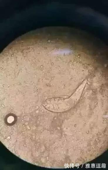 被褥|女子睫毛里长了100多只虫子! 有这个习惯的要当心了