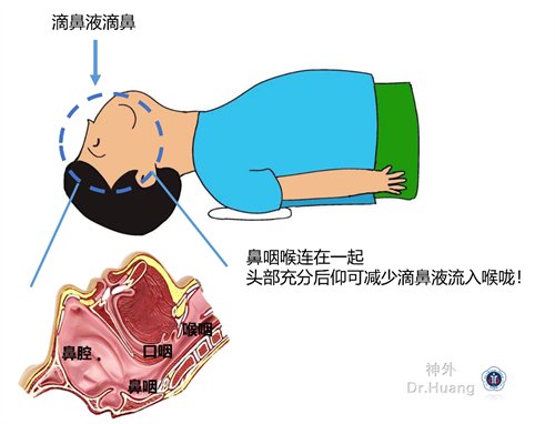 垂体瘤的10个症状