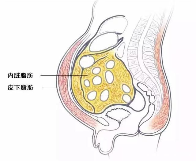 肝脏|我那么瘦，怎么会得脂肪肝？医生：你可能是个苗条的“胖子”