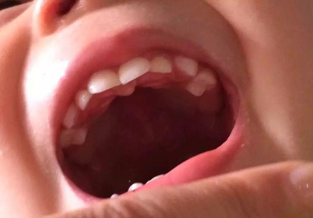 宝宝的长牙时间，一张图让你秒懂宝宝长牙顺序！