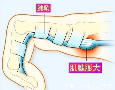 疼痛|为什么更年期的女性出现各种疼痛?该咋办?请看此文,医生告诉您