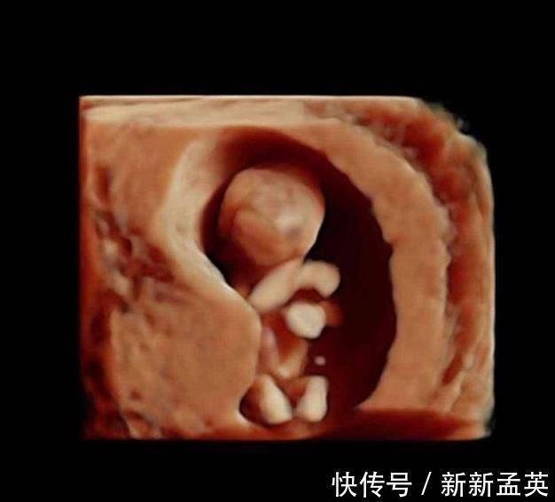 胚胎|胎儿从卵泡到性别形成,17张图片清晰诠释,男宝女宝看得很清楚