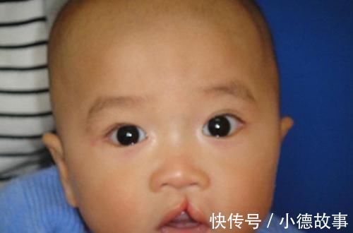 孕期|产妇生出“兔唇儿”,谎称孕期吃了兔肉,被揭穿后婆婆很生气