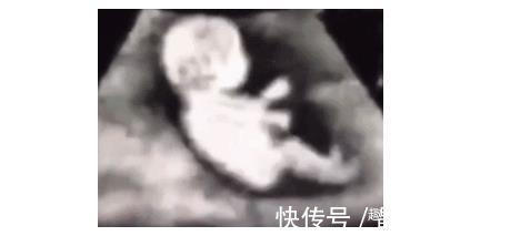 宝宝|9个月胎儿在肚子里的萌表情，你见过几个，医生现在孩子成精了