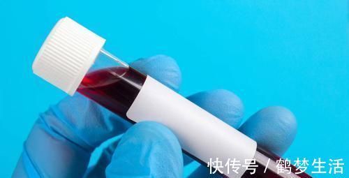 排尿困難|前列腺有癌，小便先知，排尿若出現三個特征，最好去檢查PSA