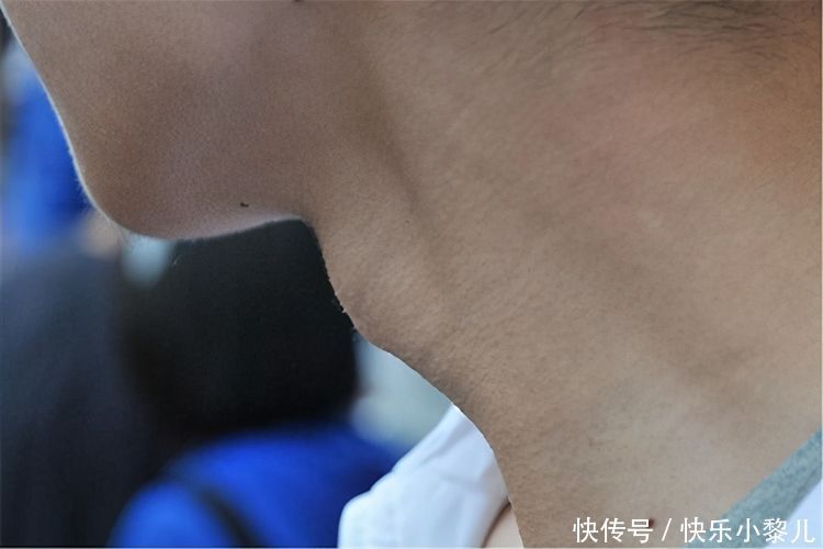 青春期|10岁孩子进入变声期,妈妈带娃去检查,医生:第二性特征开始明显