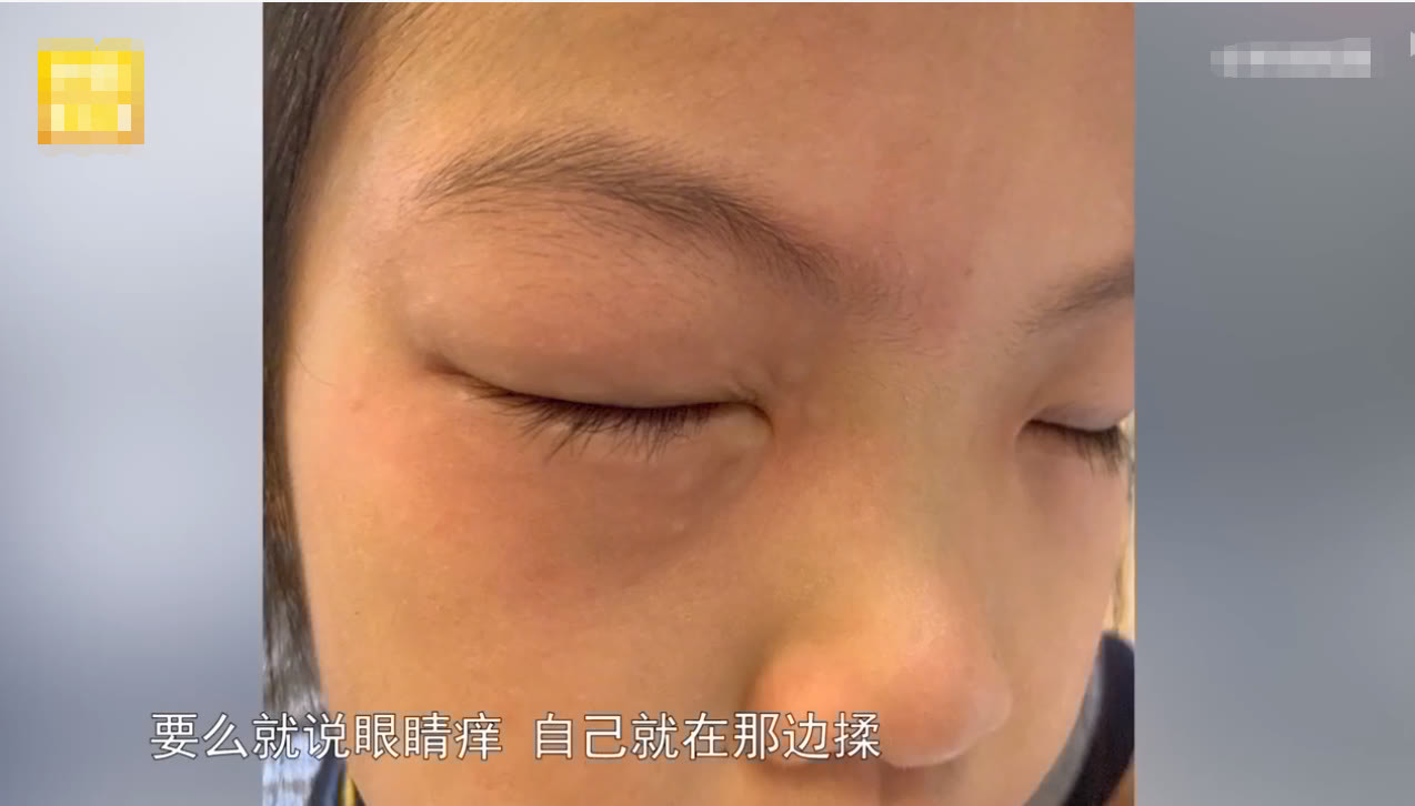 做题|女孩一做题就过敏,父母多次求医无果,没想到原因竟是它