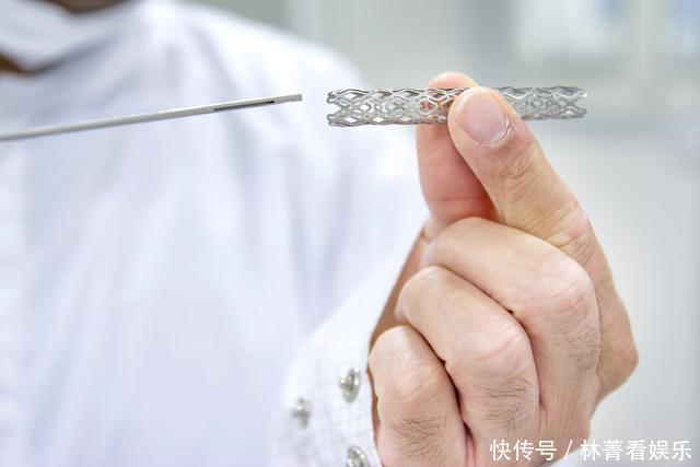 一个支架究竟多少钱?国产支架和进口支架哪个好?药师道出实情