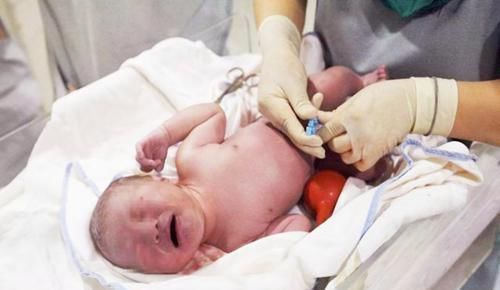 不算|宝宝头部被剖腹产划伤,凭啥不算“事故”院方的回应很有道理