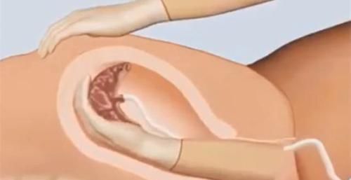 产妇|产后2小时,产妇的身体会发生什么变化看完感慨妈妈不容易