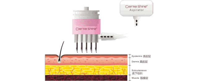 变美 有没有什么快速拯救颜值的变美神器?这些医美安排上,你就是最靓的仙女~