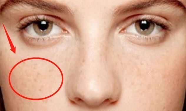 脸是子宫的“晴雨表”,若出现4大不良异常,子宫或已“稀巴烂”