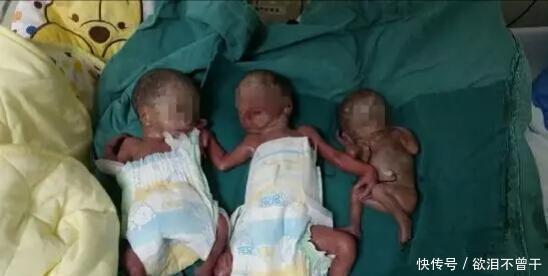 检查|孕妈生下双胞胎后,突然大喊“等一下”,医生检查后发现意外之喜