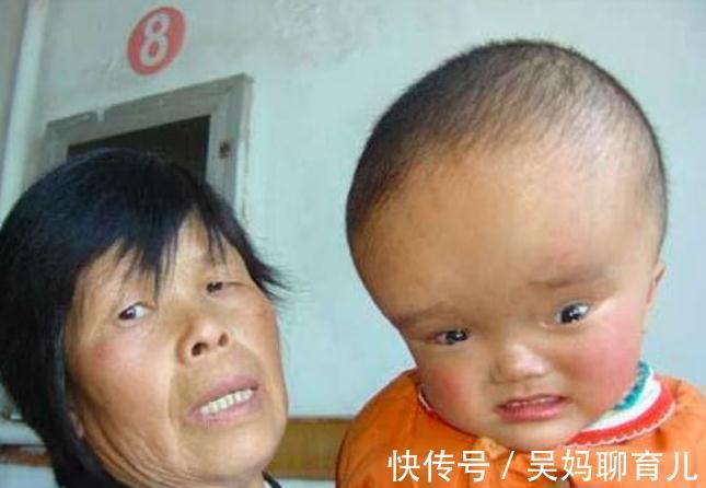 三鹿奶粉|三鹿奶粉原董事长将被提前释放,受害的“大头娃娃”会原谅她吗?