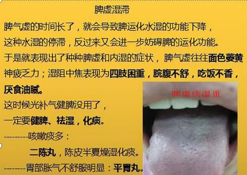 神疲乏力|脾气虚、脾阳虚，这6种脾虚，从初级到严重，你是属于哪一种？