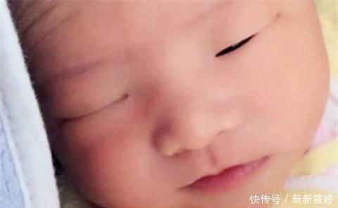 无知|7斤女婴出生12天仍不睁眼,紧急送医后,医生怒骂家长的无知