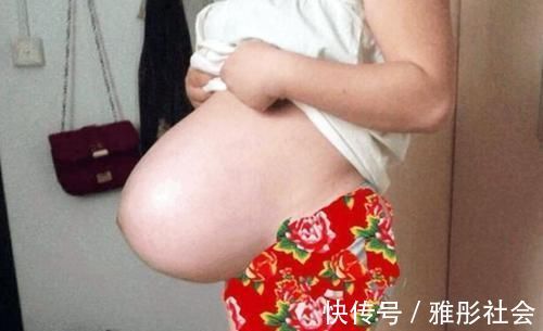 妈妈|孕妈什么时候“显怀”才正常？过早显怀，可能和这些原因有关系