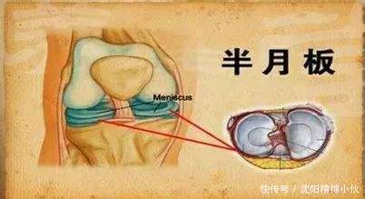  剧烈|冬季如何避免运动损伤？专家教你这样“动”！