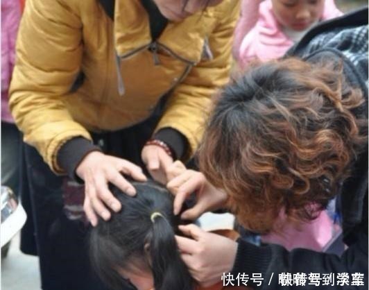 女儿|小女儿总说头皮痒,妈妈用手电筒一照,身上的鸡皮疙瘩都起来了!
