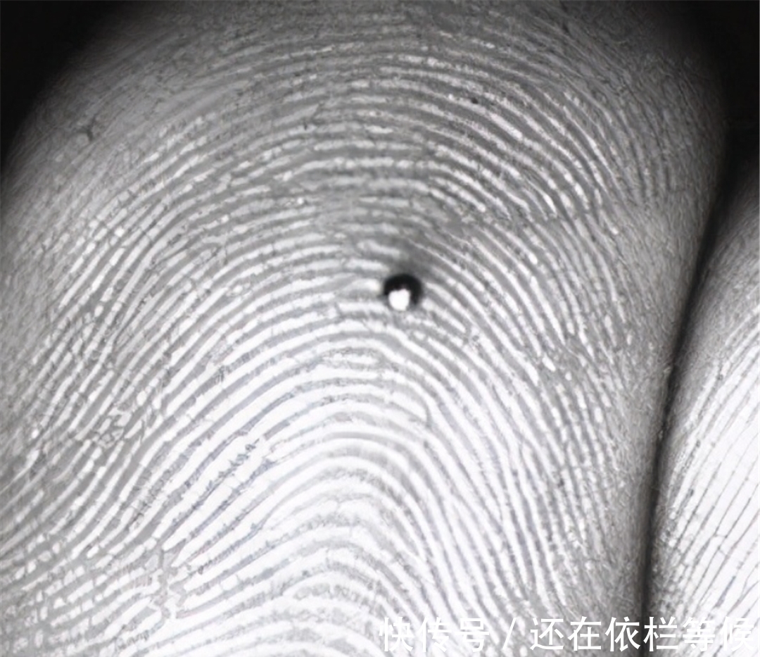 毒药|农村常见的蓖麻,却是暗杀界完美毒药,很多人小时候吃过玩过