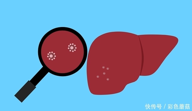 肝不好要少吃鱼腥草?医生:为了肝脏,平时应少吃几种伤肝食物