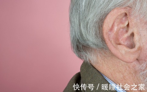 特征|血脂高的人,面部有3个特征,若都没有,血管还算健康