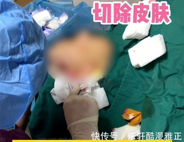 非法行医罪 女子花一万在朋友家做拉皮手术,最终成面瘫,朋友无证被逮捕