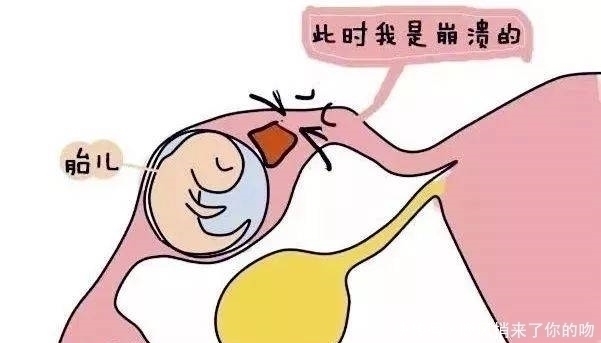 b超检查|35岁孕妇22周四维却发现子宫没有胎儿,孩子哪去了呢