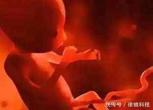 双胞胎|4岁小女孩肚子大的好像孕妇一样,经检查后父母痛心不已