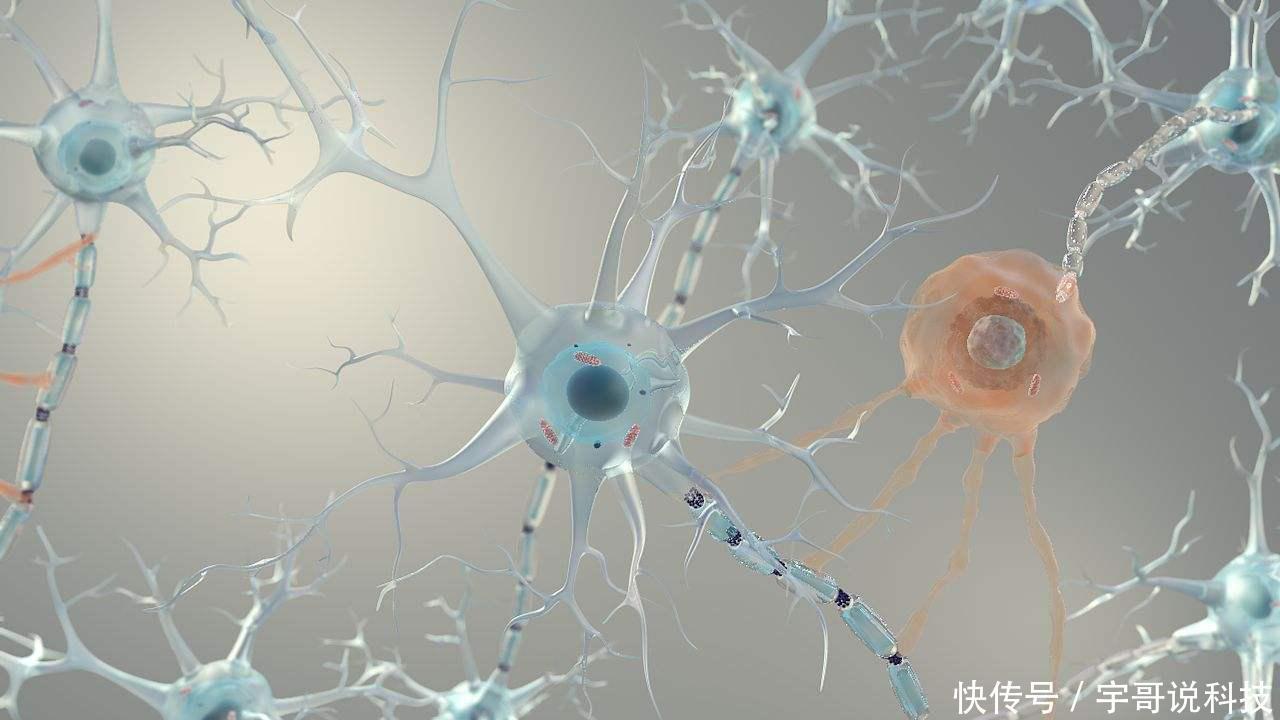 压力|老年痴呆症无法痊愈,老人做好4件事,不给子女添压力