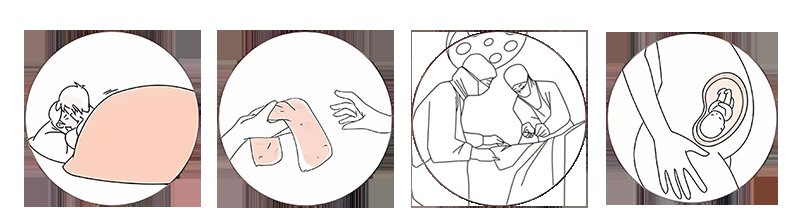 传播途径|HPV与HIV,傻傻分不清楚?