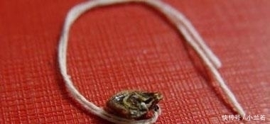 败血症|新手爸妈粗心大意, 宝宝出生不到一个月就得了败血症