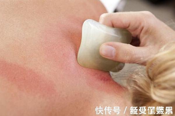 补充阳气|阳气不足百病来,补阳气有哪些好方法啥时候补阳气是最佳时机