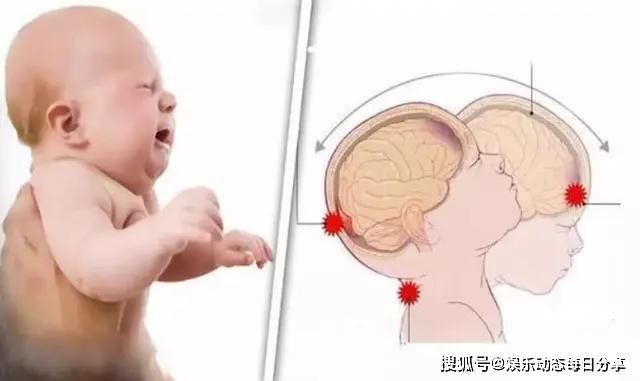 婆婆|8个月男婴，被奶奶“哄成”脑瘫儿，竟还有家长不知悔改