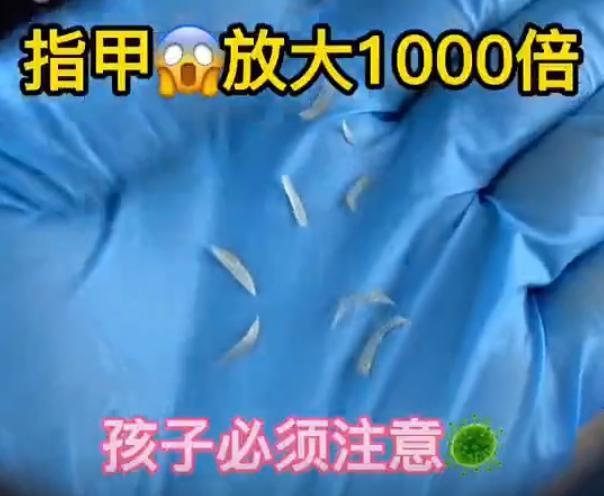 孩子啃指甲到底会吃下去多少“细菌”?网友直呼看完后头皮发麻!