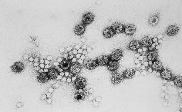 五价轮状病毒|8月初记得打这支自费疫苗