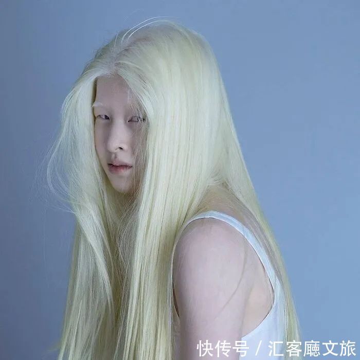 逆袭|因“全身雪白”被遗弃的中国女孩,逆袭成超模的故事让人泪目