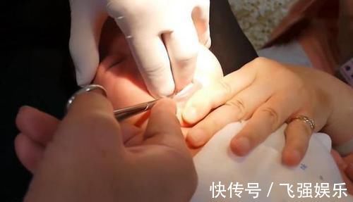 家长|宝宝1岁不会说话,奶奶拿剪刀要“剪舌根”,医生:回去吧治不了
