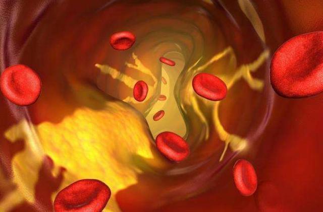 胆汁|糖尿病饮食“四宜五忌”原则,餐后“四个行动”,让血糖更听话