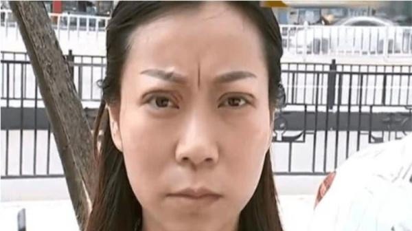 整容 女子做双眼皮手术,额头却多出个“天眼”,整容院手术很成功!