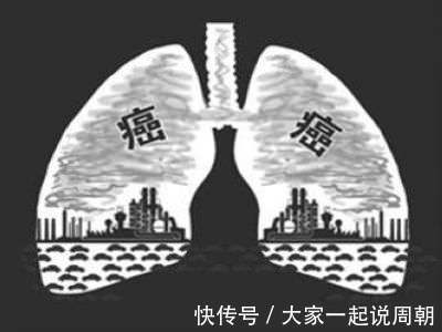 癥狀|4種比較狡猾的癌癥，早期幾乎沒癥狀，別等晚期才后知后覺
