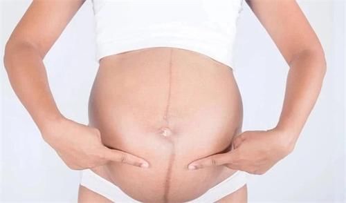 【家家月嫂】孕肚上的“黑线”可以判断宝宝性别？真相是……