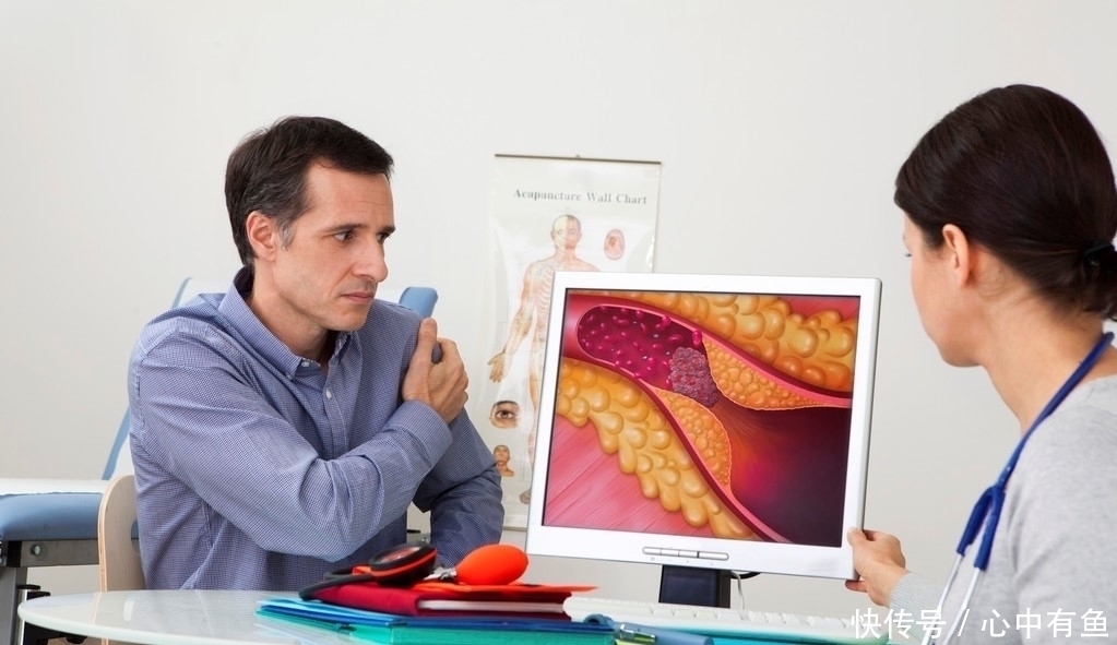 药物治疗|颈动脉的斑块,我要拿你怎么办?颈动脉斑块出现之后应该怎么做