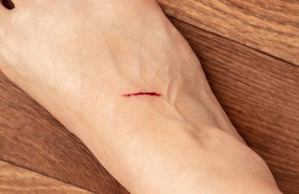 糖尿病|血糖超标,“脚”知道!脚部若没有出现4异常,祝贺,血糖很稳定