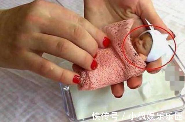 存活|世界上最小的婴儿，放在手心比巴掌还小，现在变成了这个样子