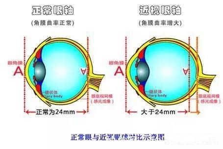 家长们|保护视力，拒绝近视！家长们看这里！