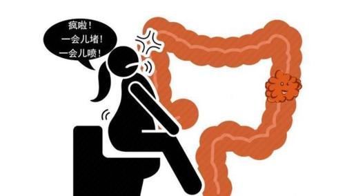 腹泻|直肠癌多半是拖出来的?4种异常迹象,暗示直肠已“亮红灯”