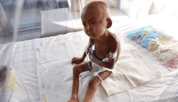 男孩|男孩瘦的只有20斤,母亲却让他禁食,得知真相让人心痛