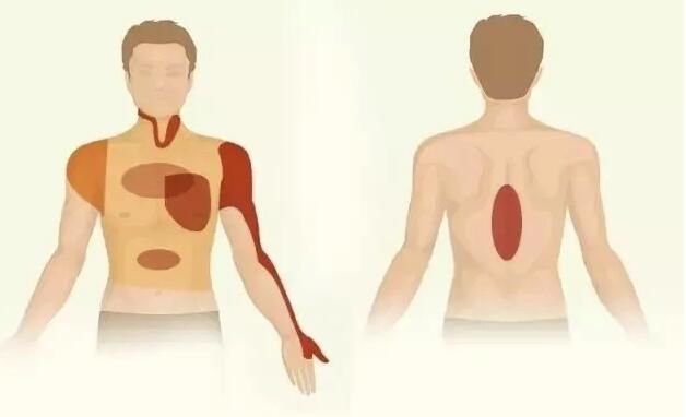 这个地方疼真不是骨科病，心跳随时可能停！45岁后互相提醒